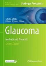 Glaucoma: Methods and Protocols