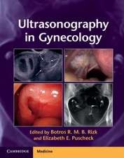 Ultrasonography in Gynecology