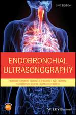 Endobronchial Ultrasonography 2e