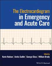 The Electrocardiogram in Emergency and Acute Care