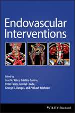 Endovascular Interventions