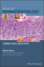 Atlas of Dermatopathology Tumors, Nevi, and Cysts