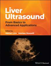 Liver Ultrasound: From Basics to Advanced Applicat ions