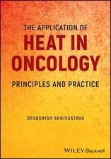 The Application of Heat in Oncology – Principles and Practice