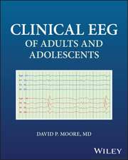 Clinical EEG of Adults and Adolescents