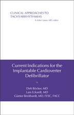 Current Indications for the Implantable Cardioverter Defibrillator