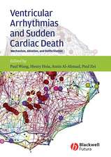 Ventricular Arrhythmias and Sudden Cardiac Death – Mechanism, Ablation and Defibrillation