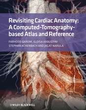 Revisiting Cardiac Anatomy – A Computed–Tomography – Based Atlas and Reference