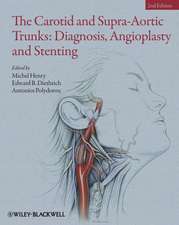 The Carotid and Supra–Aortic Trunks – Diagnosis, Angioplasty and Stenting