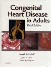 Congenital Heart Disease in Adults