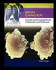 Skin Cancer: Current and Emerging Trends in Detection and Treatment