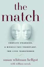 The Match: Complete Strangers, a Miracle Face Transplant, Two Lives Transformed