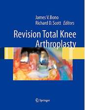 Revision Total Knee Arthroplasty