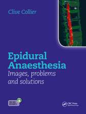 Epidural Anaesthesia: Images, Problems and Solutions