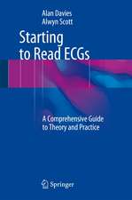 Starting to Read ECGs: A Comprehensive Guide to Theory and Practice