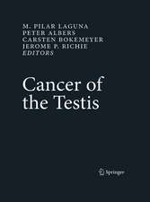 Cancer of the Testis