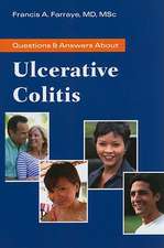 Questions & Answers about Ulcerative Colitis: Lung Cancer