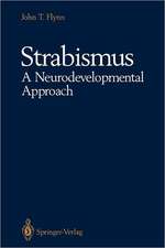 Strabismus A Neurodevelopmental Approach: Nature’s Experiment