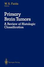 Primary Brain Tumors: A Review of Histologic Classification