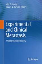 Experimental and Clinical Metastasis: A Comprehensive Review