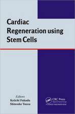 Cardiac Regeneration using Stem Cells