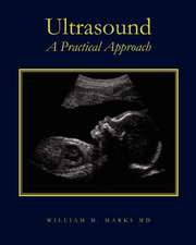 Ultrasound