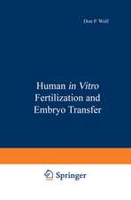 Human in Vitro Fertilization and Embryo Transfer