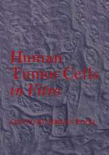 Human Tumor Cells in Vitro