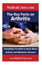 The Key Facts on Arthritis