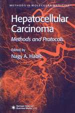 Hepatocellular Carcinoma: Methods and Protocols