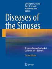 Diseases of the Sinuses: A Comprehensive Textbook of Diagnosis and Treatment