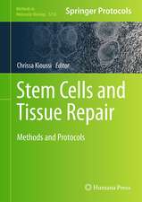 Stem Cells and Tissue Repair