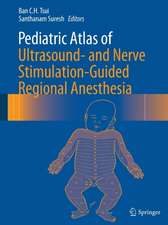 Pediatric Atlas of Ultrasound- and Nerve Stimulation-Guided Regional Anesthesia