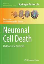 Neuronal Cell Death: Methods and Protocols