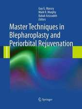 Master Techniques in Blepharoplasty and Periorbital Rejuvenation