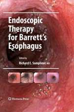 Endoscopic Therapy for Barrett's Esophagus