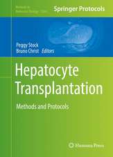 Hepatocyte Transplantation: Methods and Protocols