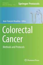 Colorectal Cancer: Methods and Protocols