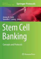 Stem Cell Banking: Concepts and Protocols