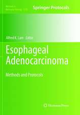 Esophageal Adenocarcinoma: Methods and Protocols