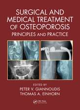 Surgical and Medical Treatment of Osteoporosis: Principles and Practice