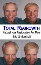 Total Regrowth