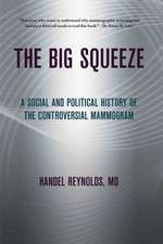 The Big Squeeze – A Social and Political History of the Controversial Mammogram