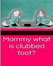 Mommy What Is Clubbed Foot?