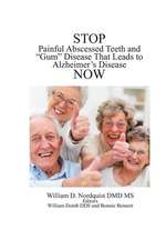 Stop Painful Abscessed Teeth and Gum Disease That Leads to Alzheimer's Now.