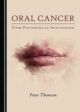 Oral Cancer