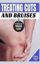 Treating Cuts and Bruises