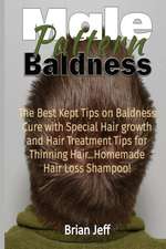 Male Pattern Baldness