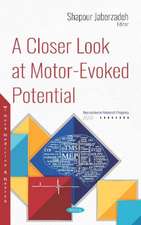 A Closer Look at Motor-Evoked Potential