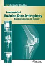 Fundamentals of Revision Knee Arthroplasty: Diagnosis, Evaluation, and Treatment